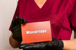 Signs of a Miscarriage