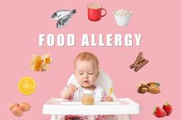 Key Strategies for Managing Food Allergies in Children